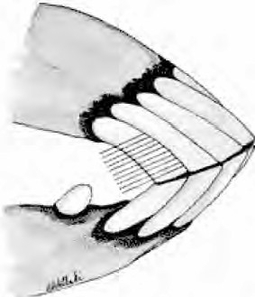 Black and white photo of Horse incisor teeth